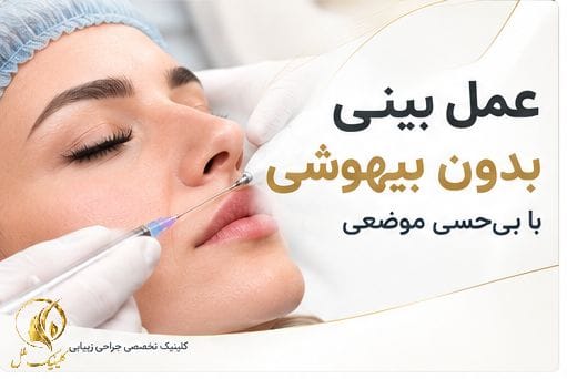 عمل بینی بدون بیهوشی با بی&zwnj;حسی موضعی