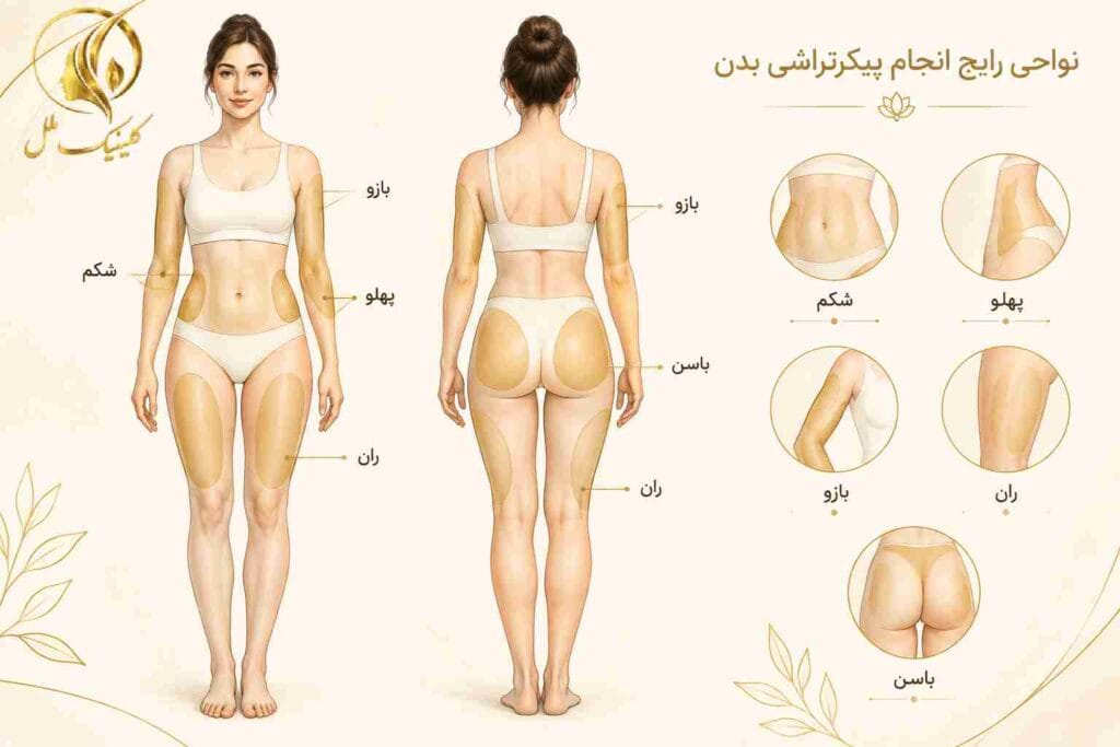 body-contouring02 نواحی رایج انجام پیکرتراشی بدن
