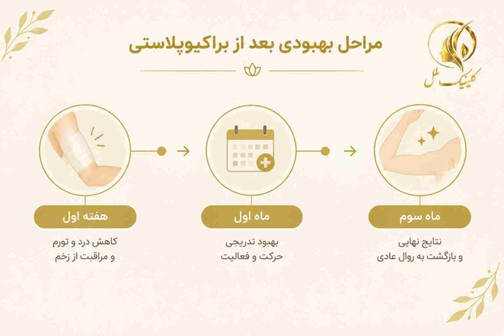 brachioplasty06 مراحل بهبودی بعد از براکیوپلاستی