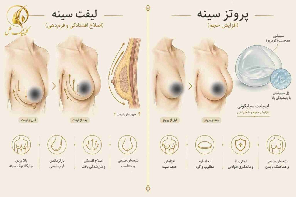 breast-lift05 تفاوت لیفت سینه و پروتز سینه