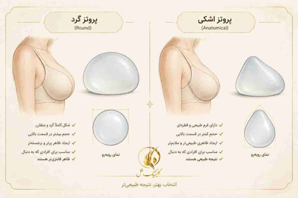 تفاوت پروتز سینه گرد و اشکی یا آناتومیک