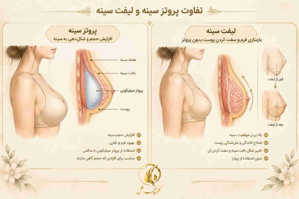 تفاوت پروتز سینه و لیفت سینه