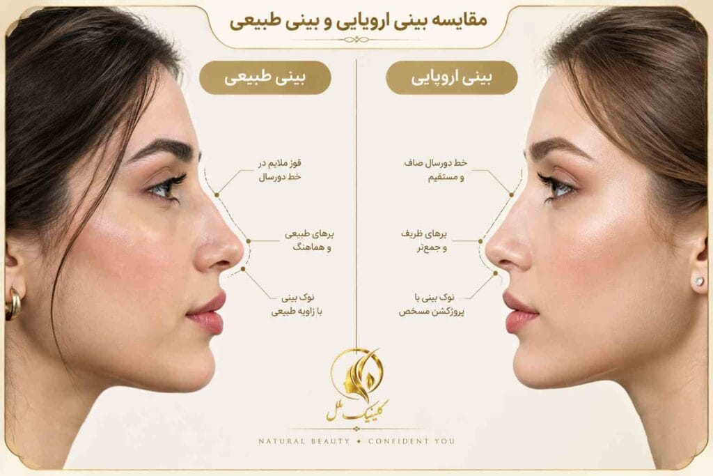 european-nose-type3 مقایسه بینی اروپایی و بینی طبیعی