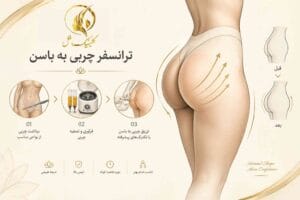 ترانسفر چربی به باسن برای افزایش حجم و فرمدهی باسن