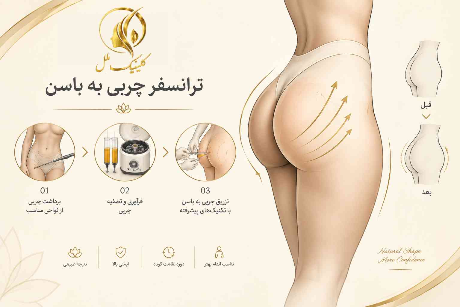ترانسفر چربی به باسن؛ روش انجام، ماندگاری، هزینه و عوارض ترانسفر چربی به باسن برای افزایش حجم و فرمدهی باسن