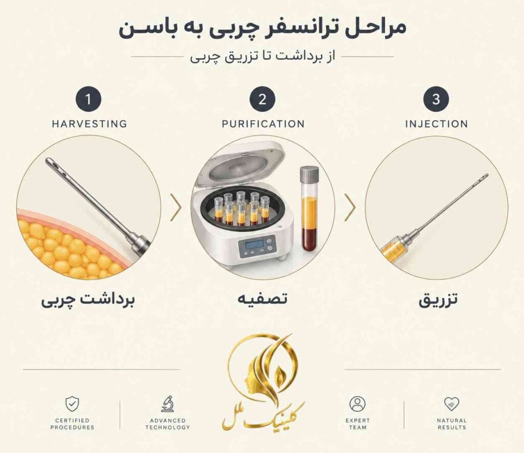 lipo-transfer04 مراحل ترانسفر چربی به باسن از برداشت تا تزریق چربی