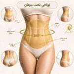 نواحی قابل درمان در لیپوماتیک ۳۶۰ درجه