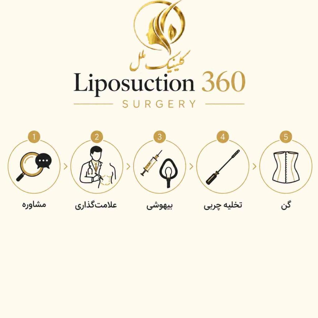 دیاگرام تعریف جراحی لیپوماتیک 360