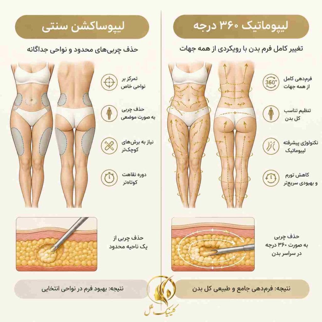 تفاوت لیپوساکشن با لیپوماتیک 360