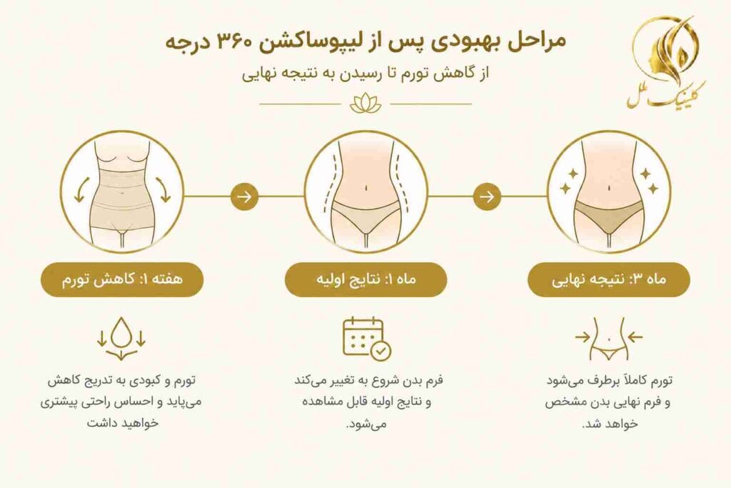 خط زمانی دوران نقاهت لیپو 360