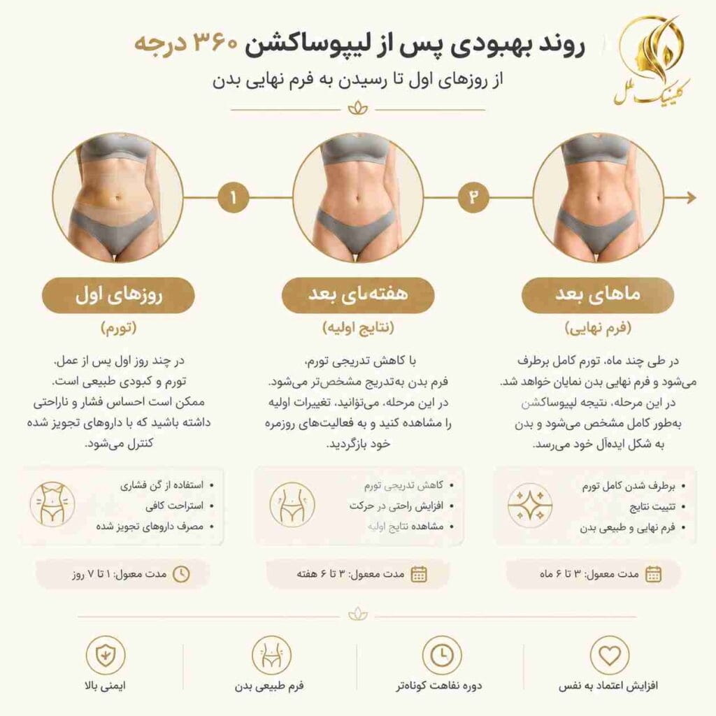 مراحل بهبودی و نقاهت بعد از لیپوماتیک 360