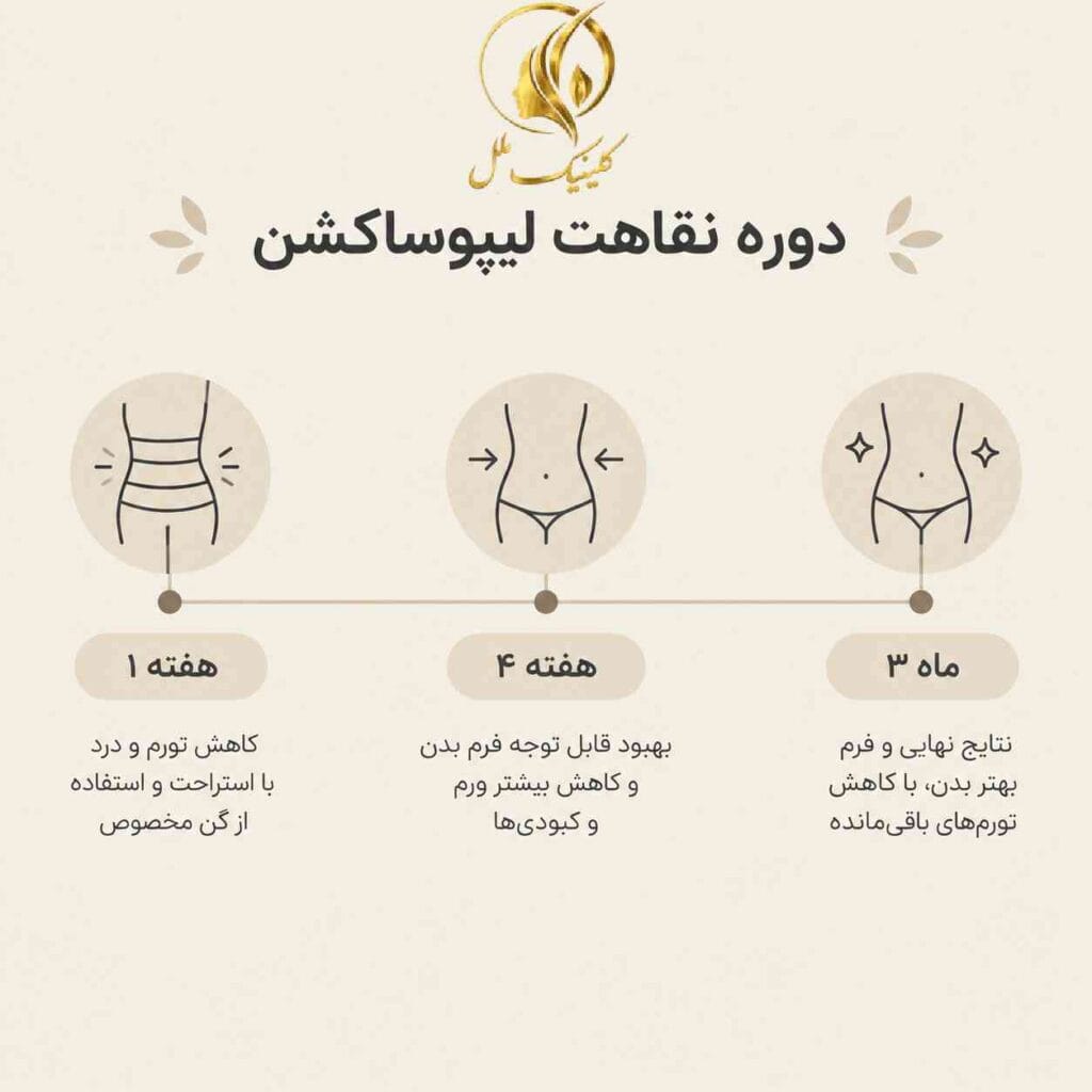 liposuction-surgery04 دوره نقاهت لیپوساکشن