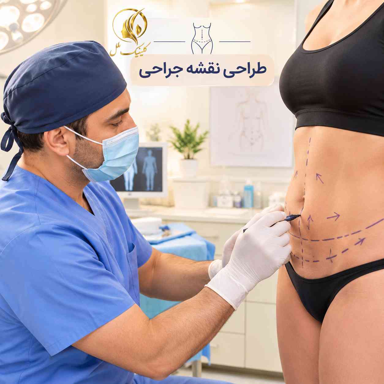 liposuction-surgery12 جراح پلاستیک در حال علامتگذاری ناحیهی لیپوساکشن روی بدن بیمار در حالت ایستاده