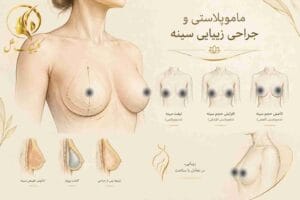 ماموپلاستی و جراحی زیبایی سینه