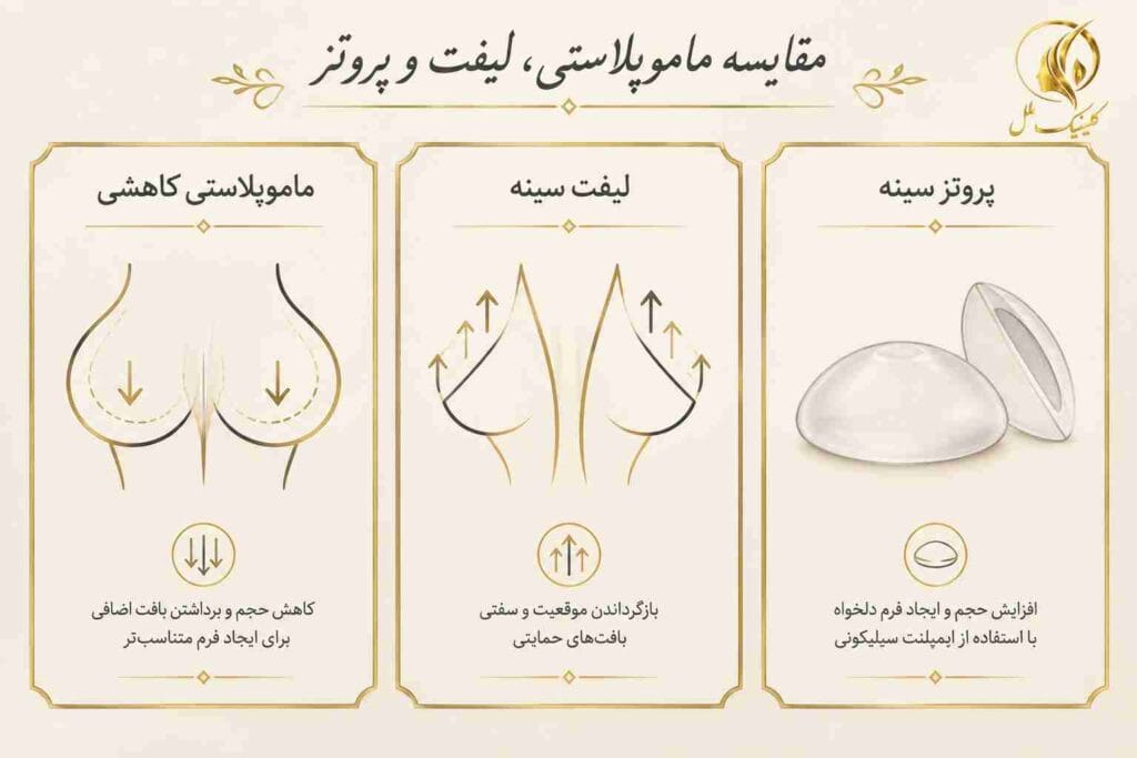 mammoplasty09 تفاوت ماموپلاستی لیفت سینه و پروتز سینه