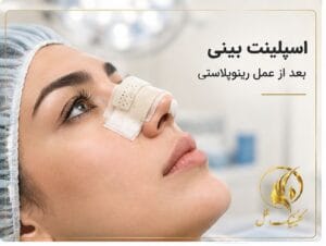 اسپلینت بینی بعد از عمل رینوپلاستی