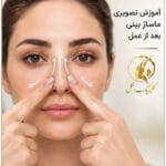 آموزش تصویری ماساژ بینی بعد از عمل