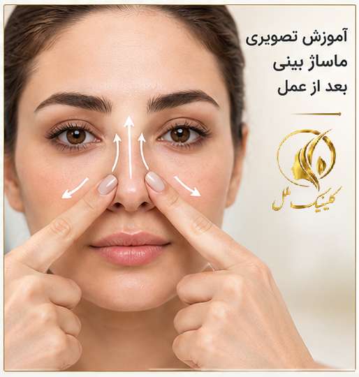 آموزش تصویری ماساژ بینی بعد از عمل