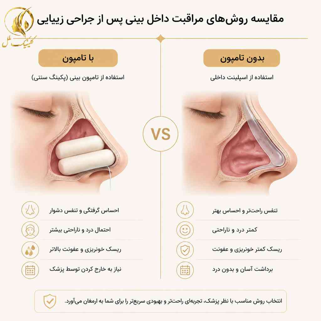 تفاوت تامپون بینی با اسپلینت داخلی در جراحی بینی