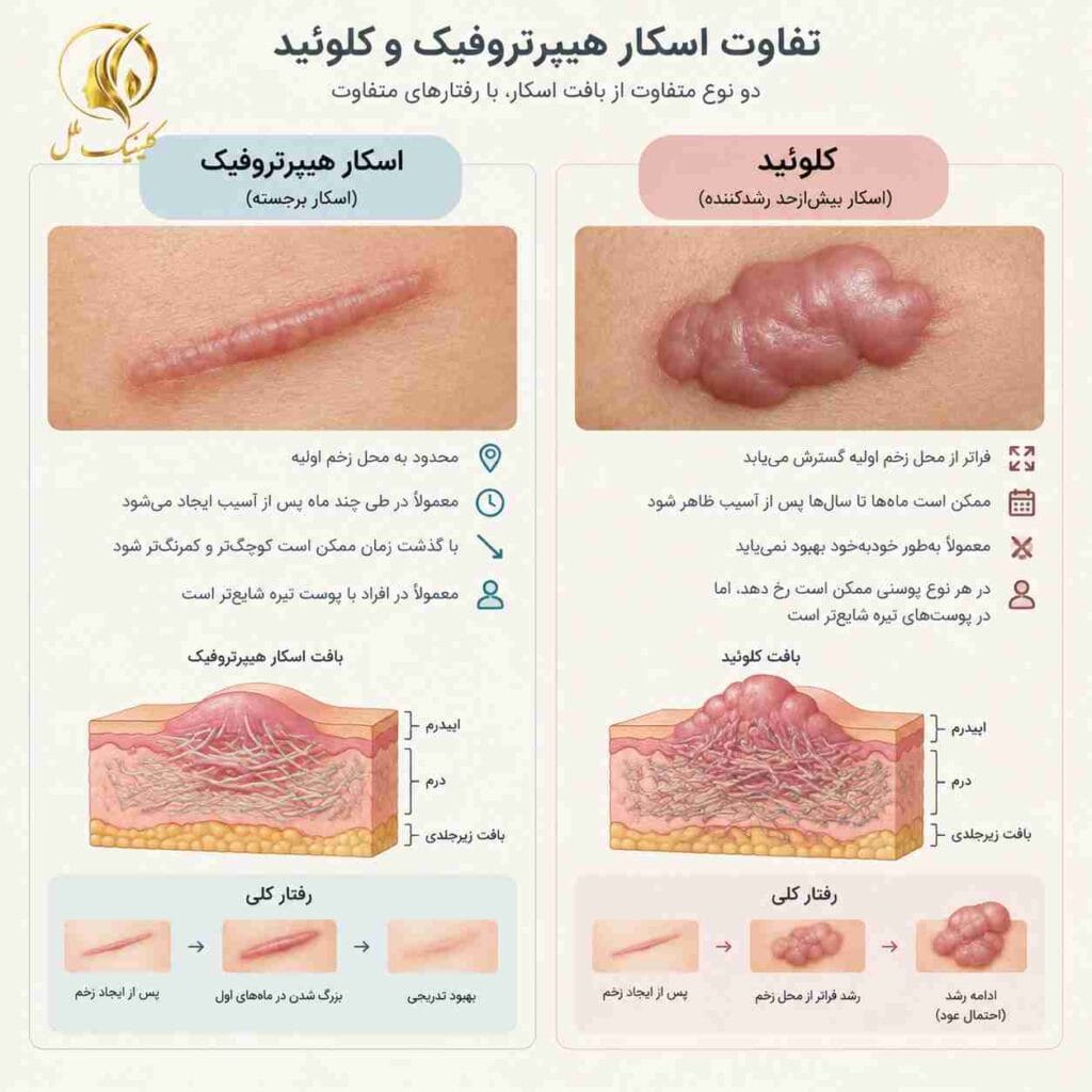 scar-removal-nosejob05 تفاوت اسکار هیپرتروفیک و کلوئید بعد از عمل بینی