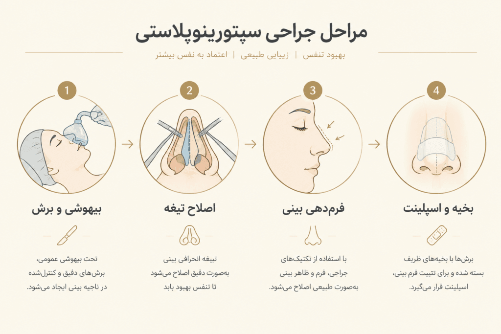 septorhinoplasty-4