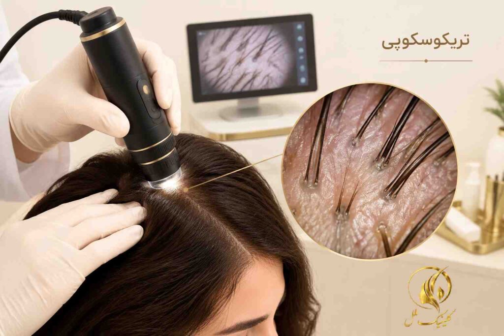 بررسی پوست سر و فولیکول&zwnj;های مو با تریکوسکوپی برای ارزیابی ریزش مو