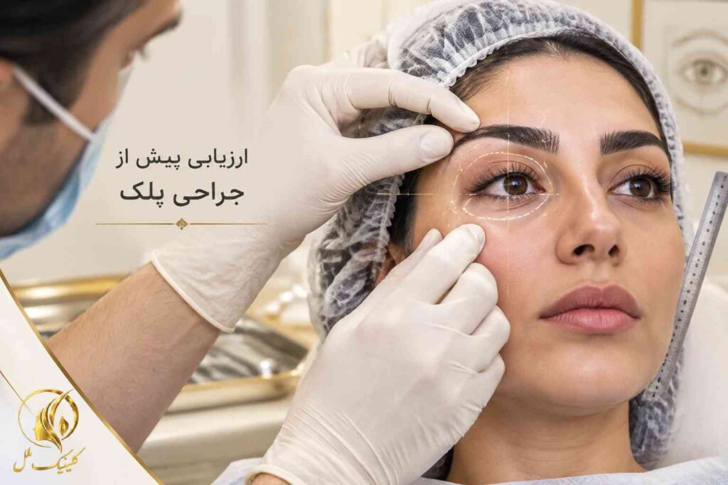 ارزیابی وضعیت پلک و اطراف چشم پیش از جراحی زیبایی