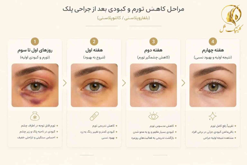 نمای آموزشی مراحل کاهش تورم و کبودی پس از جراحی پلک