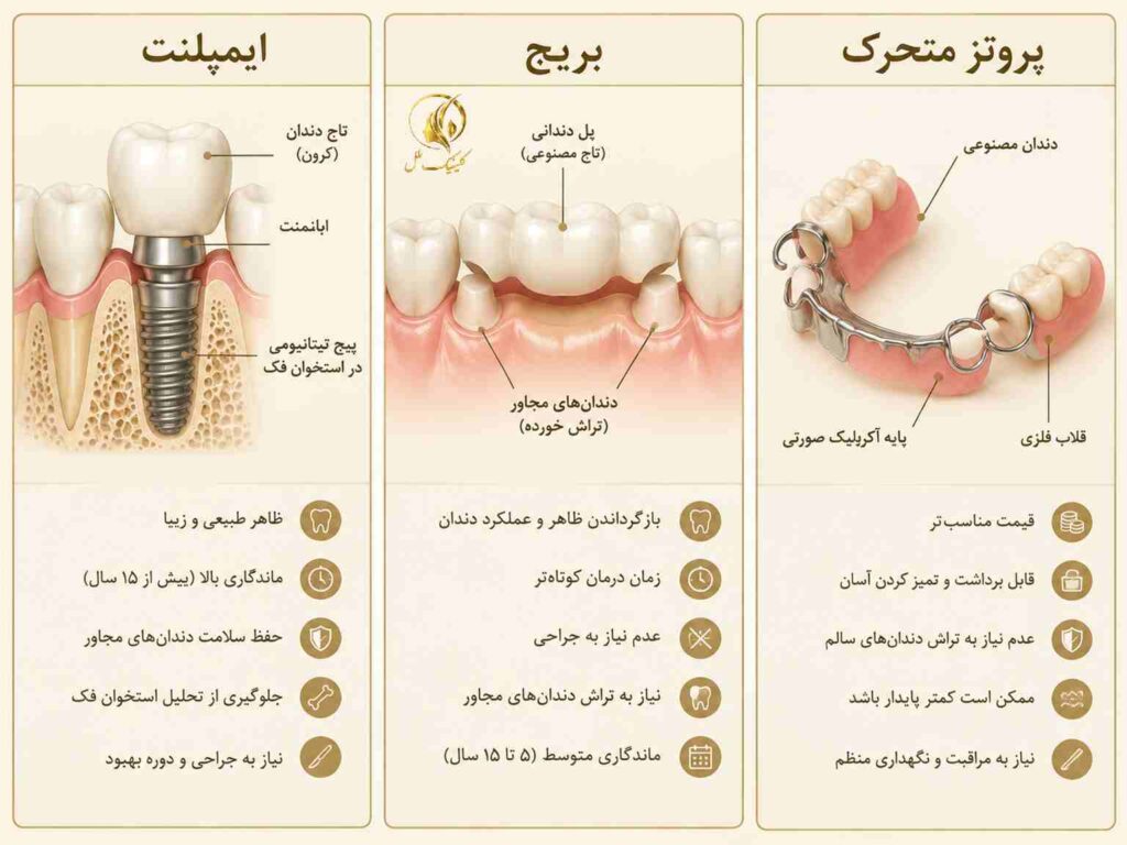 مقایسه ایمپلنت، بریج و پروتز متحرک دندان