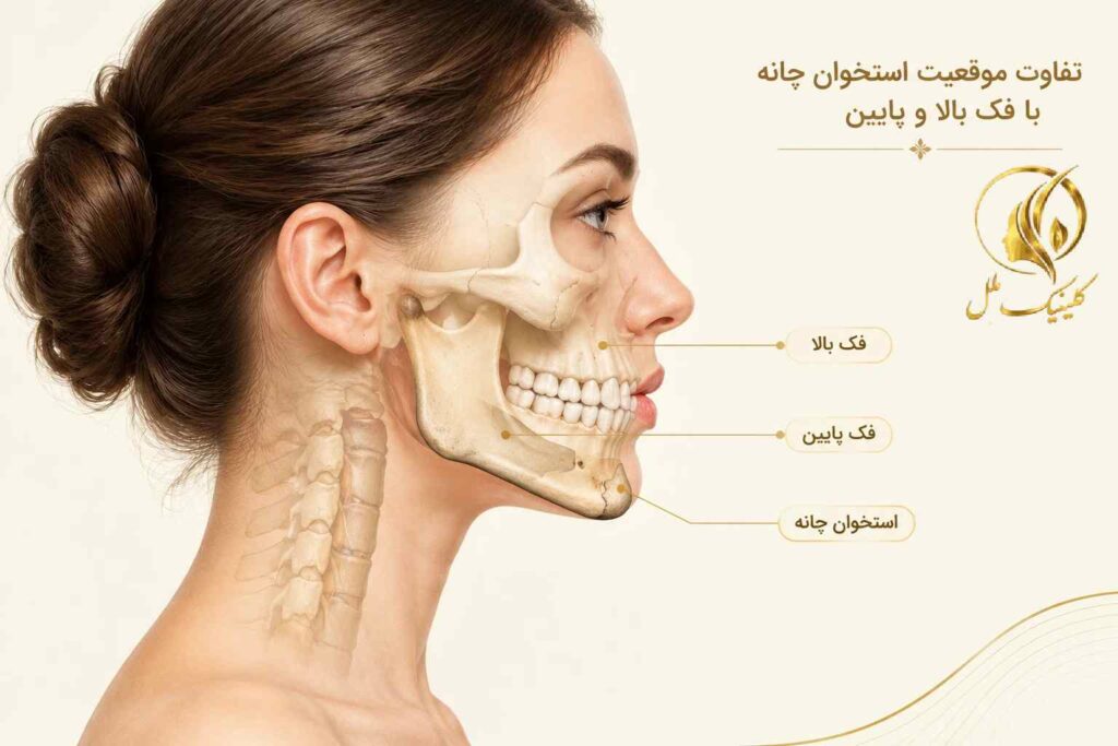 difference-genioplasty-jaw-surgery-01 تفاوت موقعیت استخوان چانه با فک بالا و پایین در نمای نیمرخ