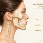 تفاوت موقعیت استخوان چانه با فک بالا و پایین در نمای نیم&zwnj;رخ