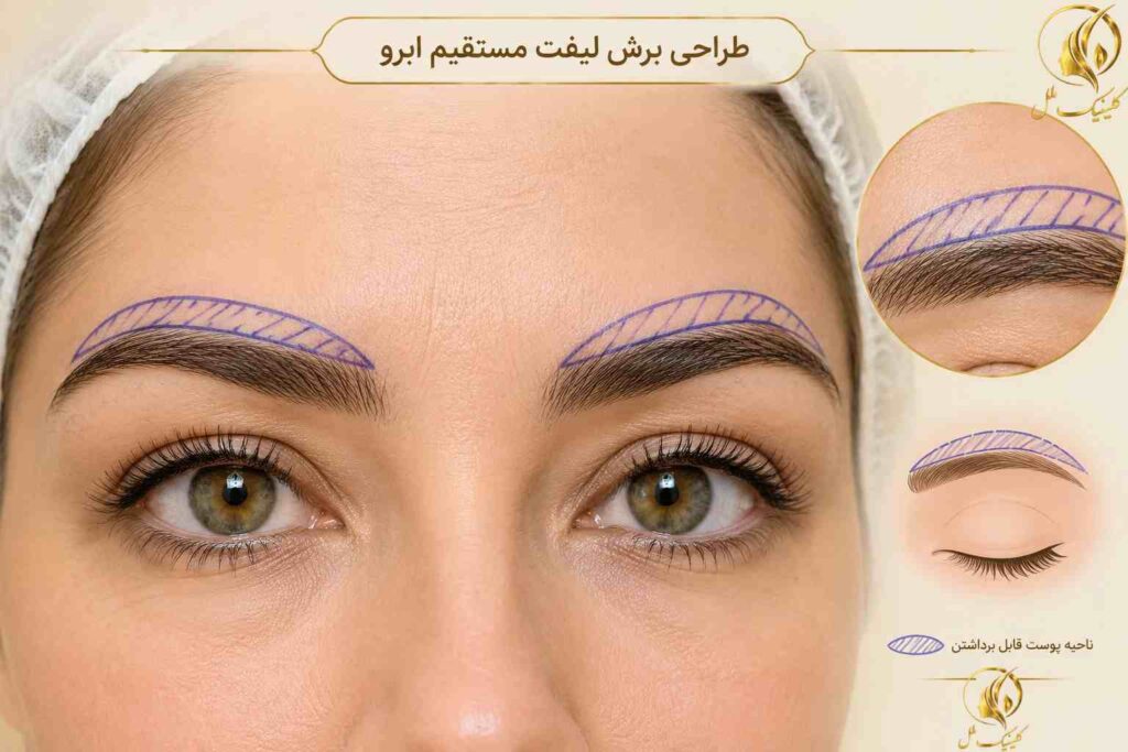 نمای آموزشی طراحی برش بالای ابرو برای لیفت مستقیم