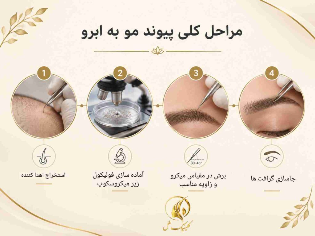 مراحل کلی پیوند مو به ابرو