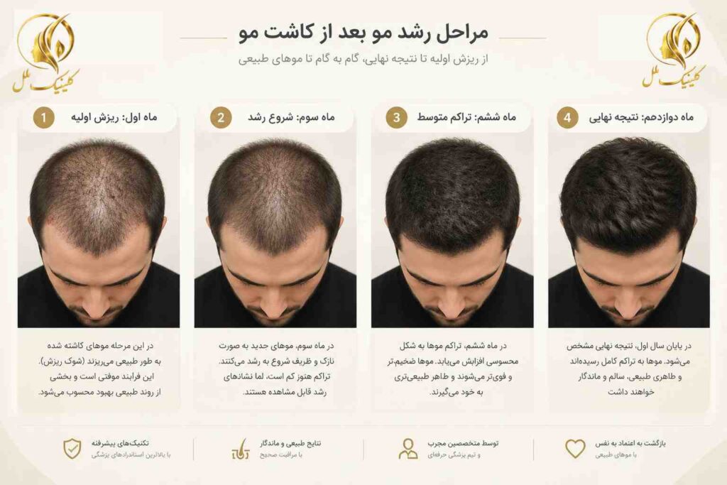 نمای شماتیک مراحل رشد مو پس از کاشت در ماه&zwnj;های مختلف