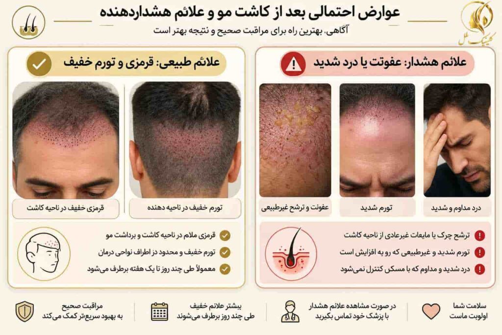 نمای آموزشی عوارض احتمالی و علائم هشدار پس از کاشت مو