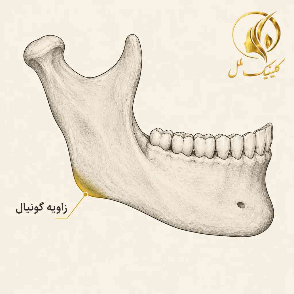 jawline-contouring-01 محل زاویه گونیال در استخوان فک پایین در نمای نیمرخ