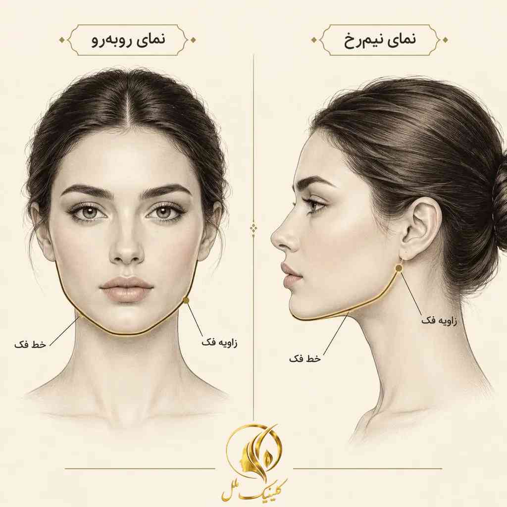 jawline-contouring-02 نمای روبهرو و نیمرخ برای توضیح خط فک و زاویه فک