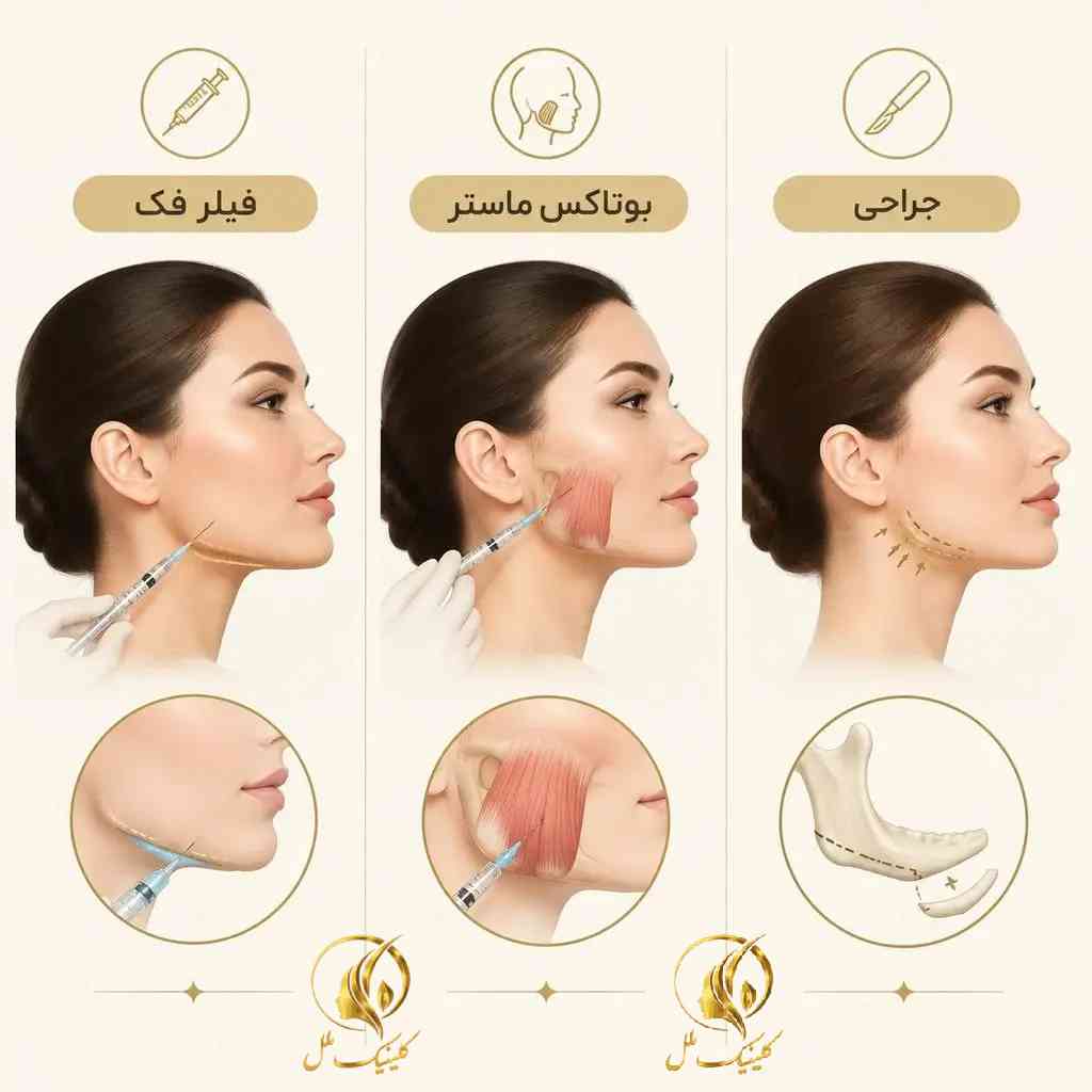 jawline-contouring-04 مقایسه شماتیک فیلر فک، بوتاکس ماستر و روش جراحی
