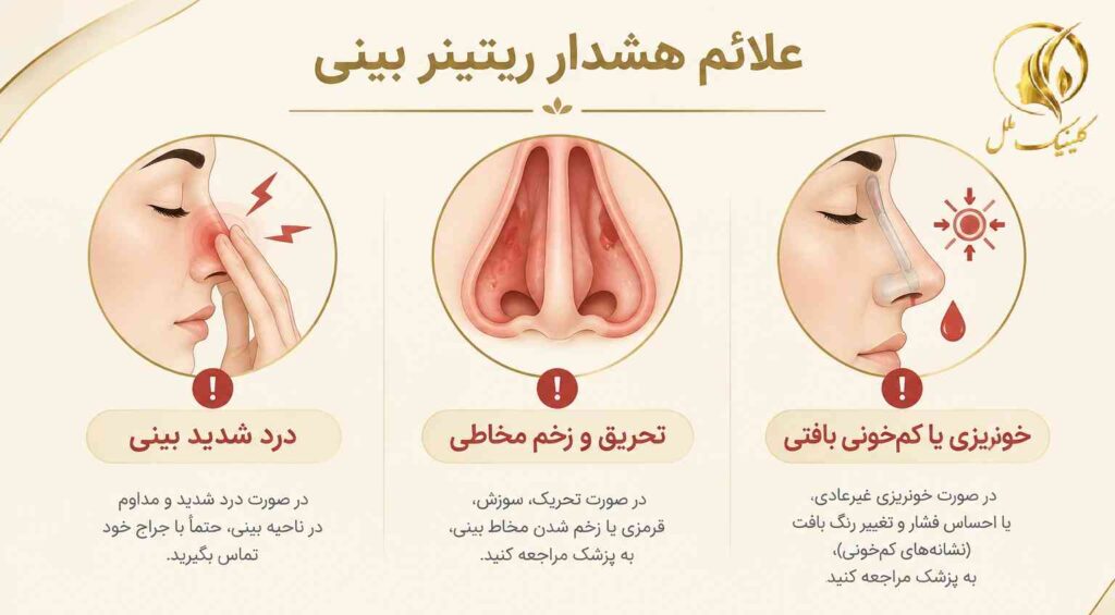 علائم هشدار هنگام استفاده از ریتینر بینی مانند درد و تحریک مخاط