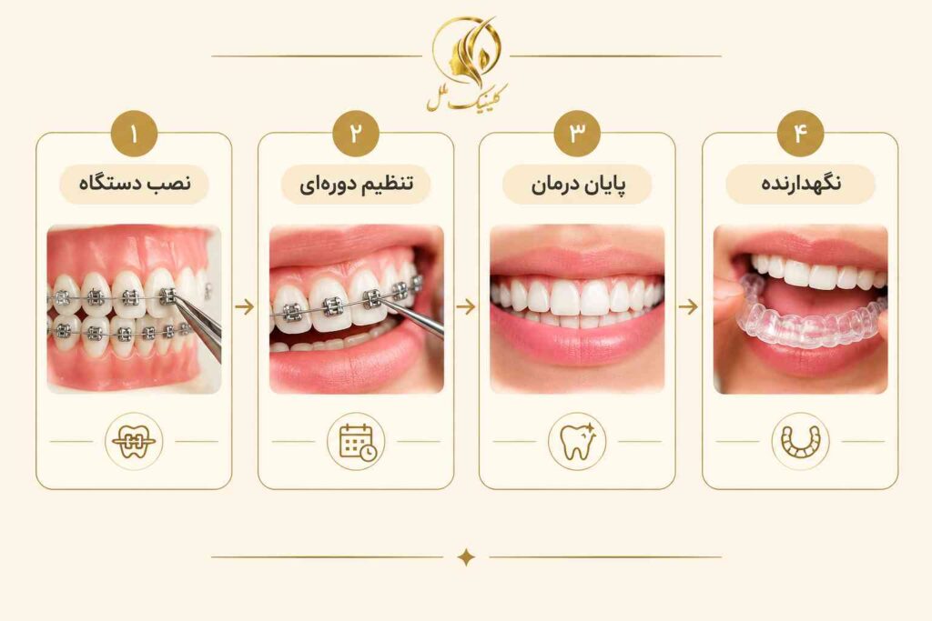 مراحل درمان ارتودنسی از نصب دستگاه تا استفاده از نگهدارنده