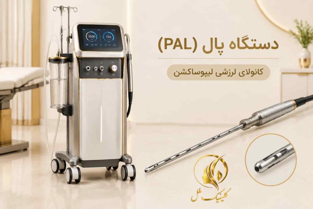تصویر آموزشی دستگاه پال و کانولای لیپوساکشن قدرتی