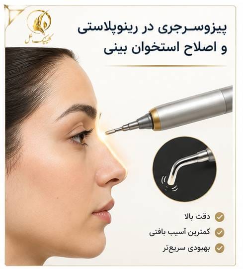پیزوسرجری در رینوپلاستی و اصلاح استخوان بینی