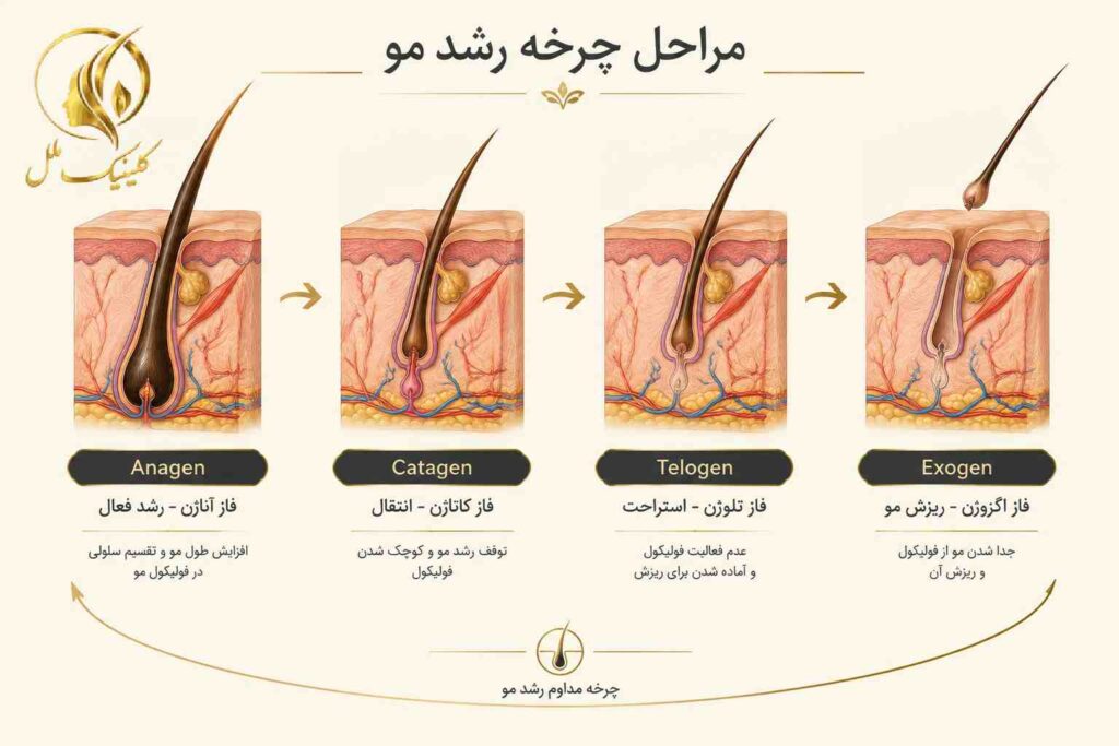 shock-loss-after-hair-transplant-04 مراحل چرخه رشد مو شامل فاز رشد آناژن و استراحت تلوژن