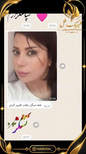 رضایت از تیپ پلاستی