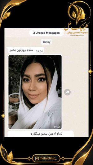 رضایت از سپتوپلاستی